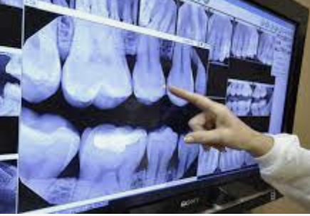 xrays xrays